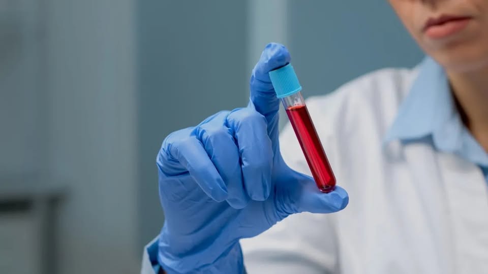 O que são os cânceres do sangue? Dr. Kalil e especialistas explicam quadros
